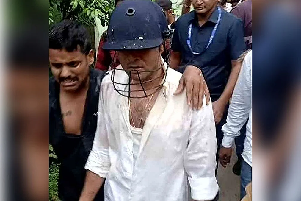 Avishek_Attacked_01