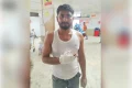 কোরবানি ও মাংস কাটাকাটি করতে গিয়ে আহত শতাধিক