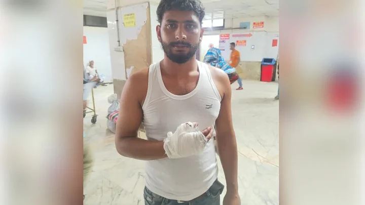 কোরবানি ও মাংস কাটাকাটি করতে গিয়ে আহত শতাধিক
