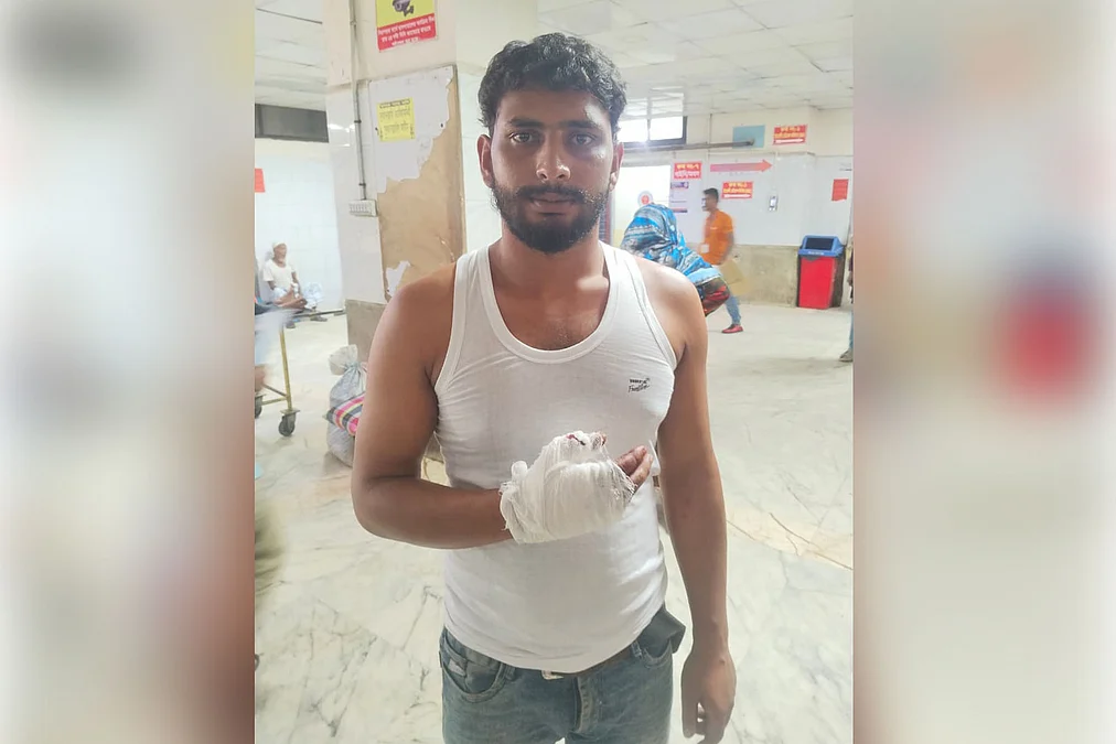 Qurbani-Injured