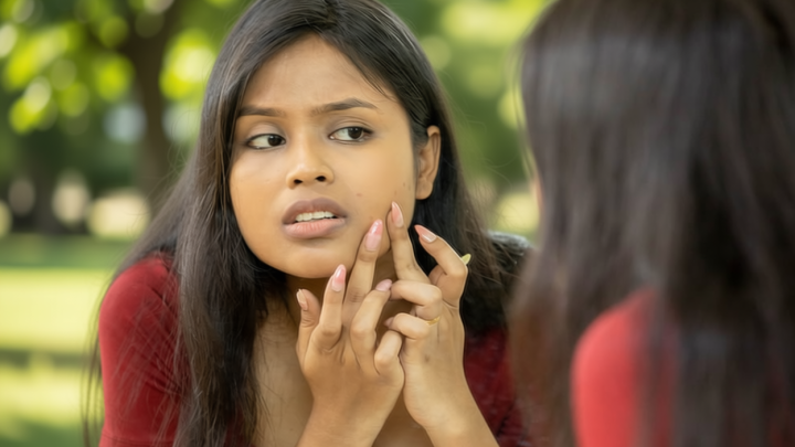 ব্রণের দাগের চিকিৎসা কী