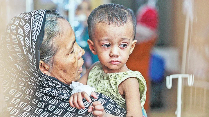 প্রতি দুজনের নমুনায় একজনের হাম শনাক্ত