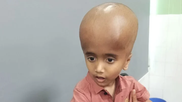 বড় মাথার যন্ত্রণায় ছটফট করে শিশুটি